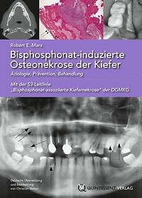Bisphosphonat-induzierte Osteonekrose der Kiefer: Ätiologie, Prävention, Behandlung