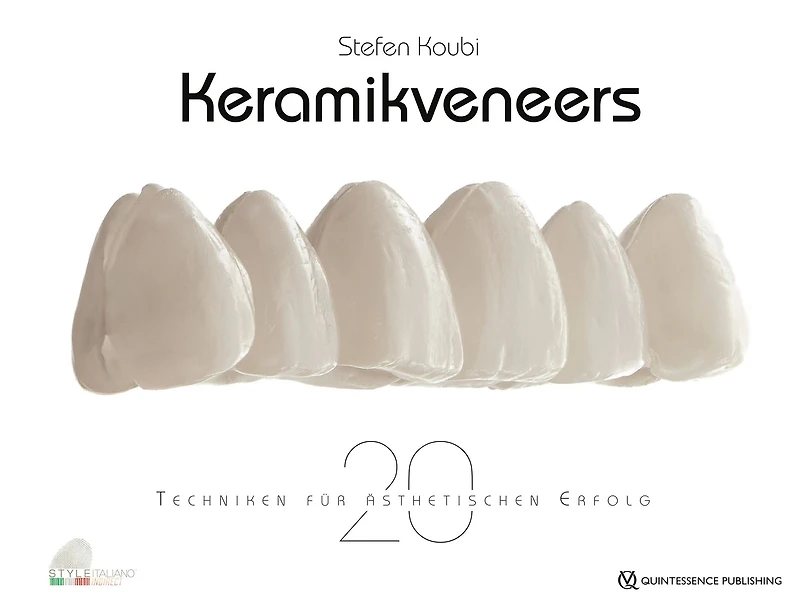 Keramikveneers: 20 Techniken für ästhetischen Erfolg