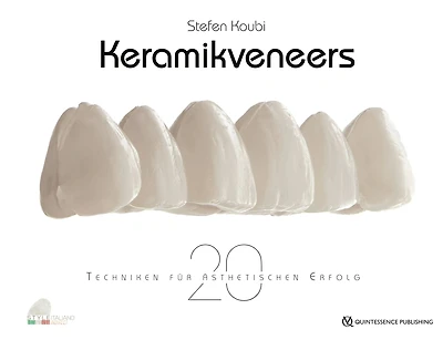 Keramikveneers: 20 Techniken für ästhetischen Erfolg