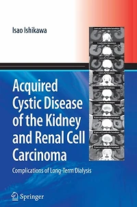 Acquired Cystic Disease of the Kidney and Renal Cell Carcinoma: Complication Long-Term Dialysis
