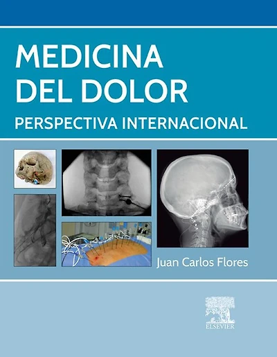 Medicina del dolor: Perspectiva internacional