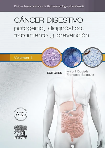 Cáncer digestivo: patogenia, diagnóstico, tratamiento y prevención: Clínicas Iberoamericanas de Gastroenterología y Hepatología vol. 1