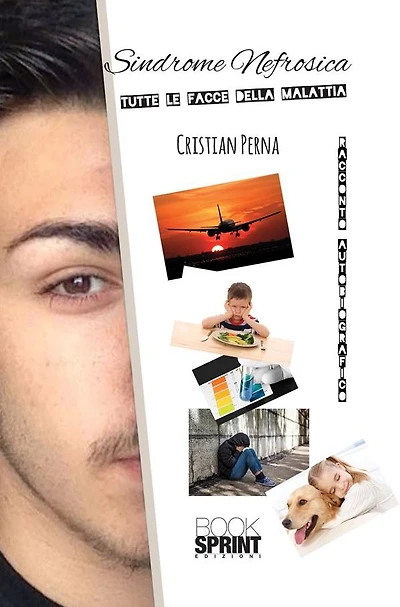 Sindrome Nefrosica