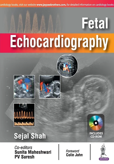 Fetal Echocardiography