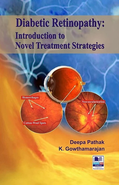 Diabetic Retinopathy: Introduction to Novel Treatment Strategies