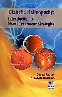 Diabetic Retinopathy: Introduction to Novel Treatment Strategies