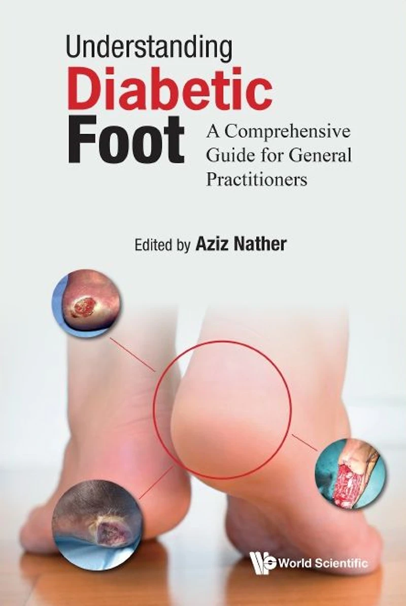 Understanding Diabetic Foot: A Comprehensive Guide For General Practitioners