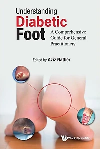 Understanding Diabetic Foot: A Comprehensive Guide For General Practitioners