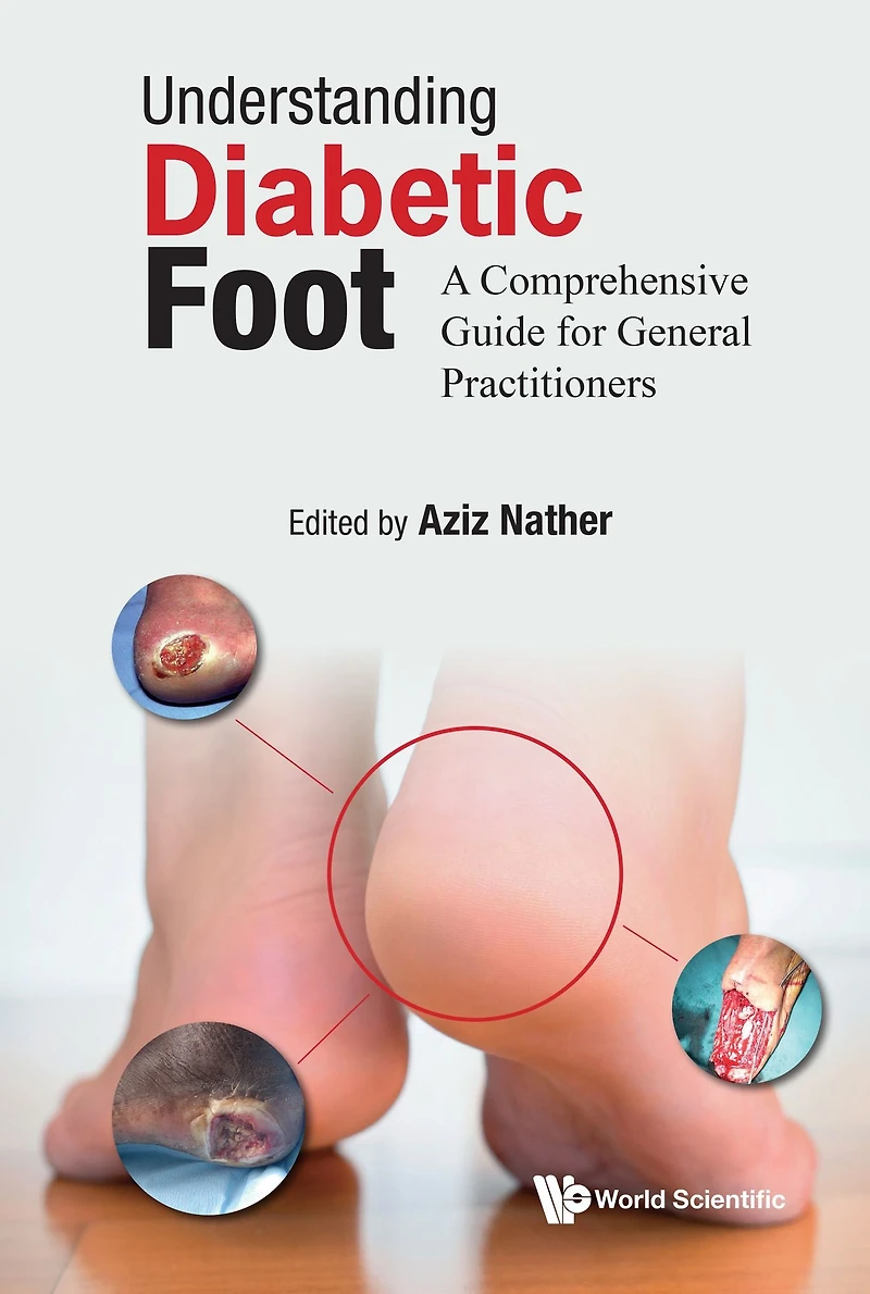 Understanding Diabetic Foot: A Comprehensive Guide For General Practitioners