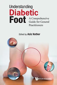 Understanding Diabetic Foot: A Comprehensive Guide For General Practitioners