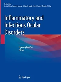 Inflammatory and Infectious Ocular Disorders