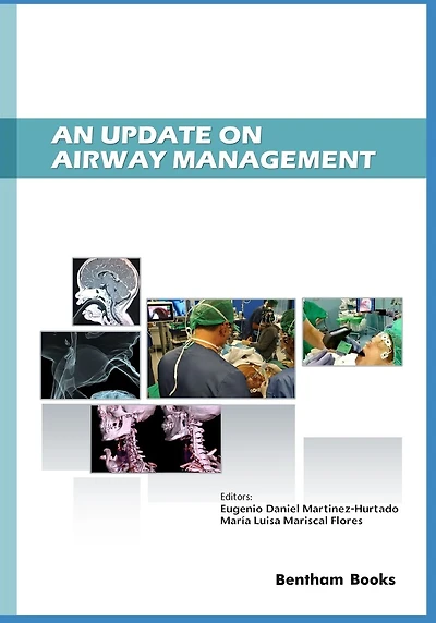 An Update on Airway Management