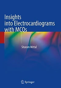 Insights into Electrocardiograms with MCQs