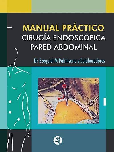 Manual Práctico de Cirugía Endoscópica de la Pared Abdominal