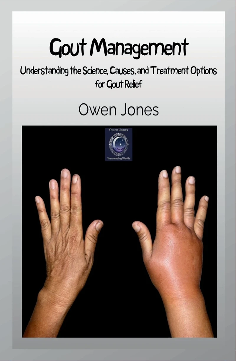 Gout Management: Understanding The Science, Causes, And Treatment Options For Relief