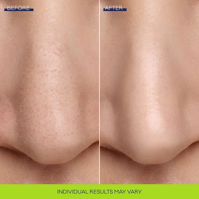Bioré Pore Refining Bubbling Nose Mask 8pcs