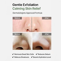 Celimax Ji Woo Gae Heartleaf BHA Peeling Pad 60pcs