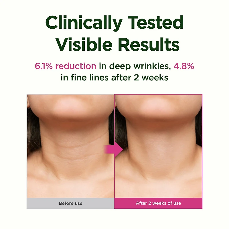 CKD Retino Collagen Small Molecule 300 Guasha Neck Cream 50ml