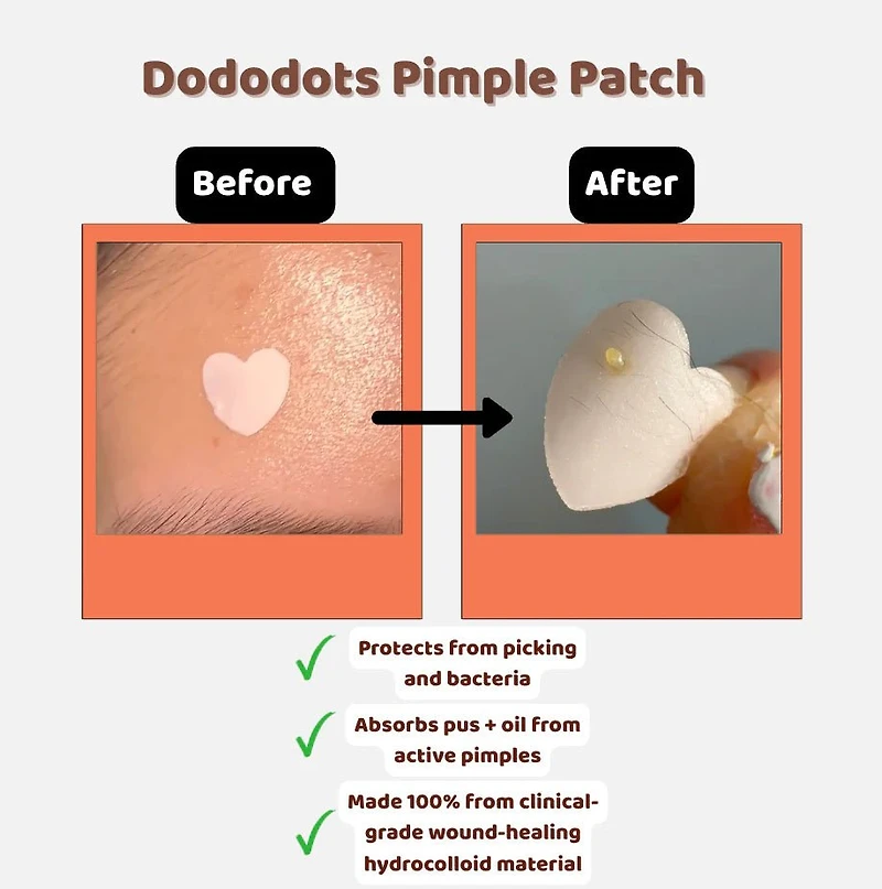 Dododots Crazy A-Bao-T You 20 pcs