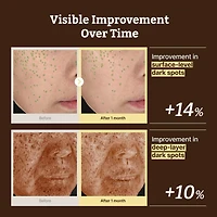 Dr.Reju-All Advanced Retino-Mela Serum 30ml
