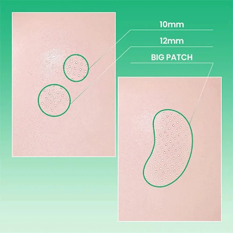 ilso No Problem Spot Patch 72P