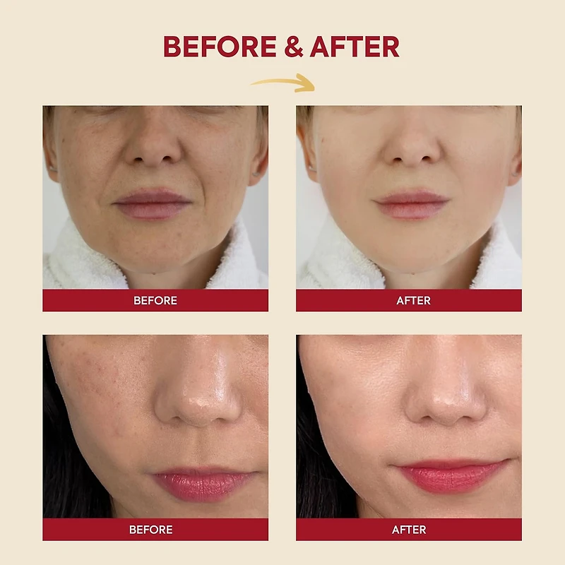 KSECRET SEOUL 1988 Essence: Snail Mucin 97% + Rice 100ml