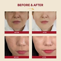 KSECRET SEOUL 1988 Essence: Snail Mucin 97% + Rice 100ml