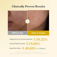 Medicube Kojic Acid Turmeric Pad 70ea