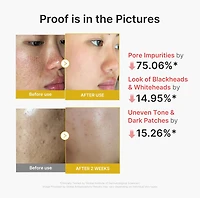 Medicube Kojic Acid Turmeric Peel Shot 80ml