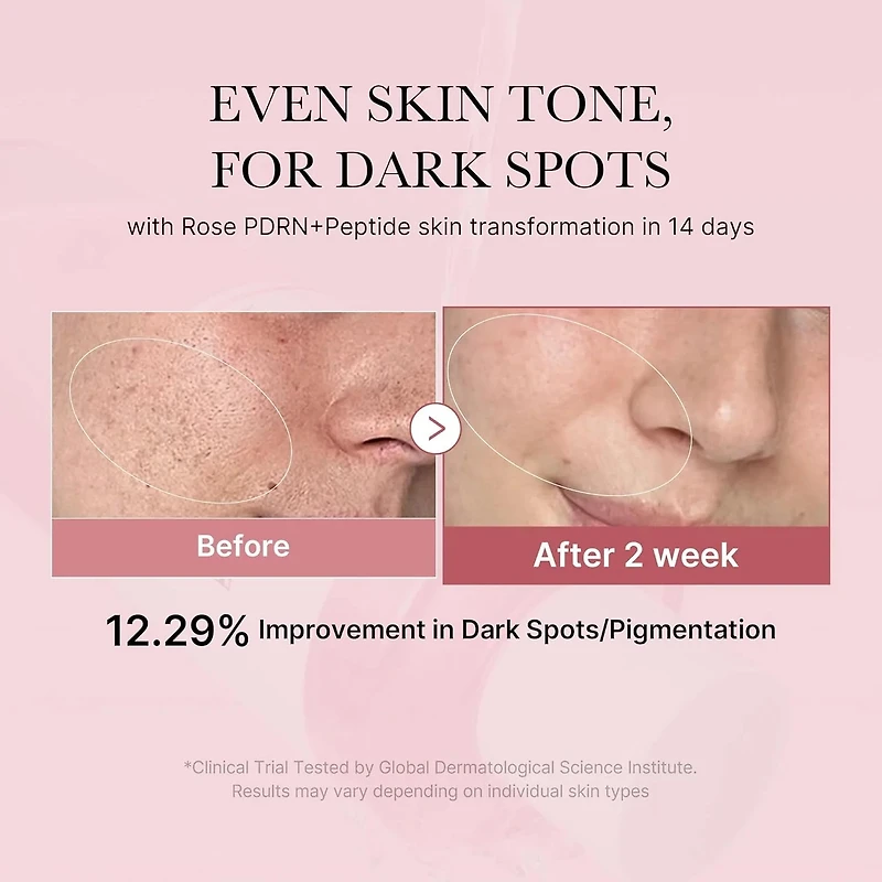 Medicube PDRN Pink Niacinamide Milky Toner 150ml