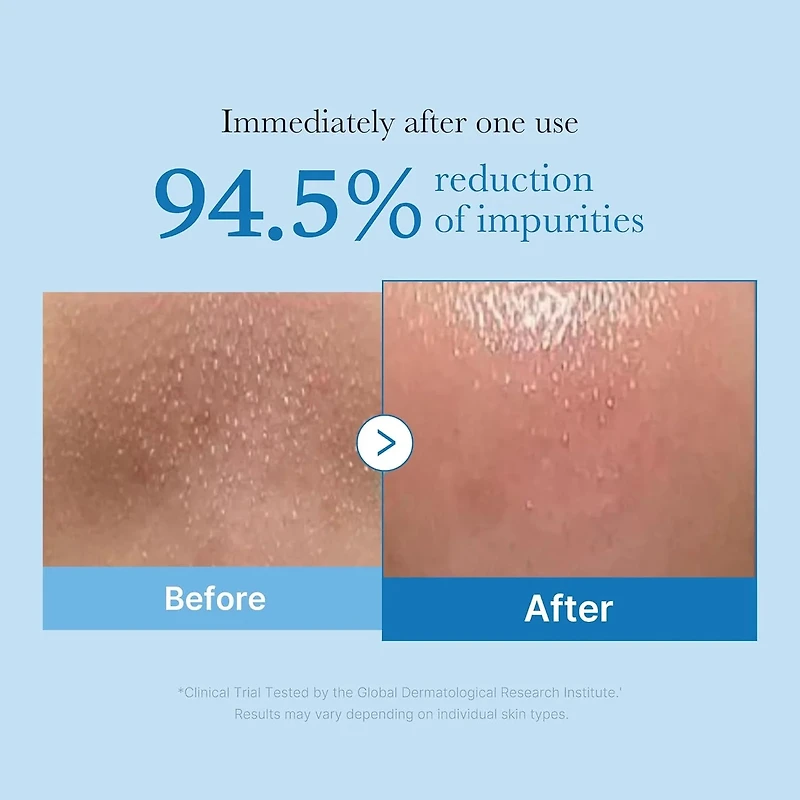 Medicube Zero Pore Blackhead Deep Cleansing Oil 205ml