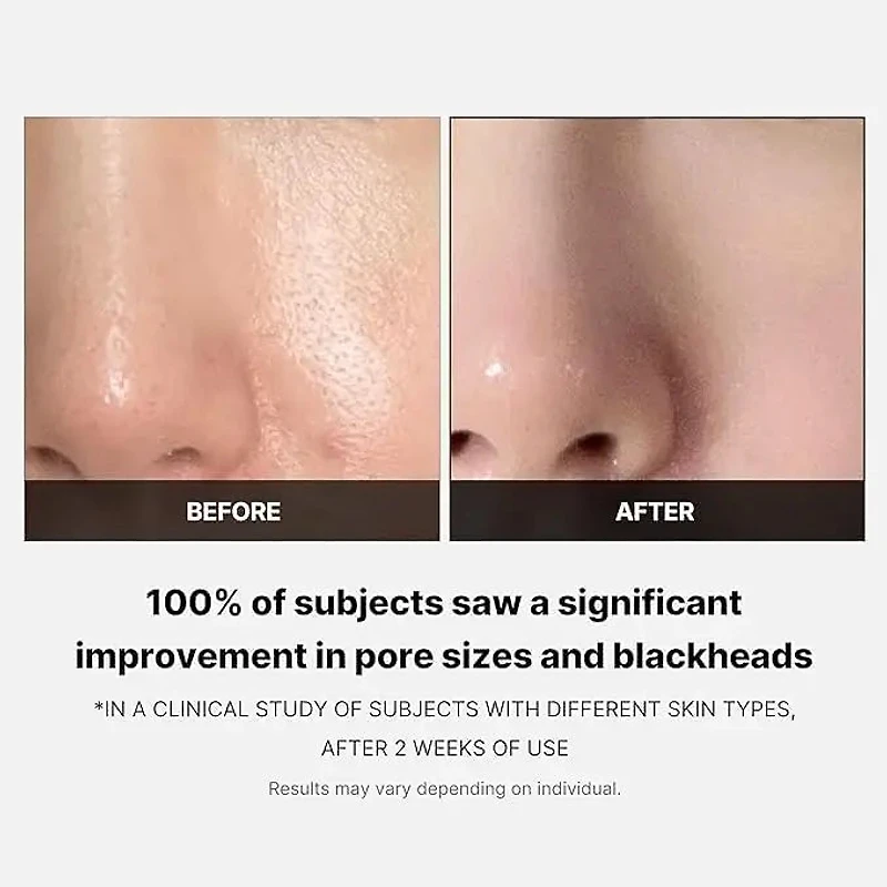 MEDICUBE Zero Pore Pad 70pads