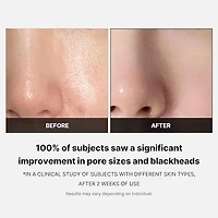 MEDICUBE Zero Pore Pad 70pads