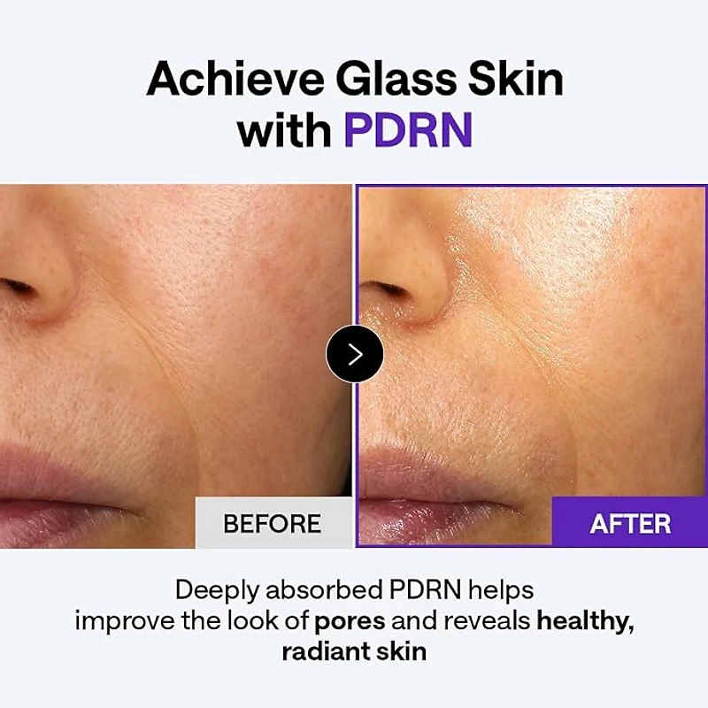 Mediheal PDRN Lifting Derma Cream 50ml