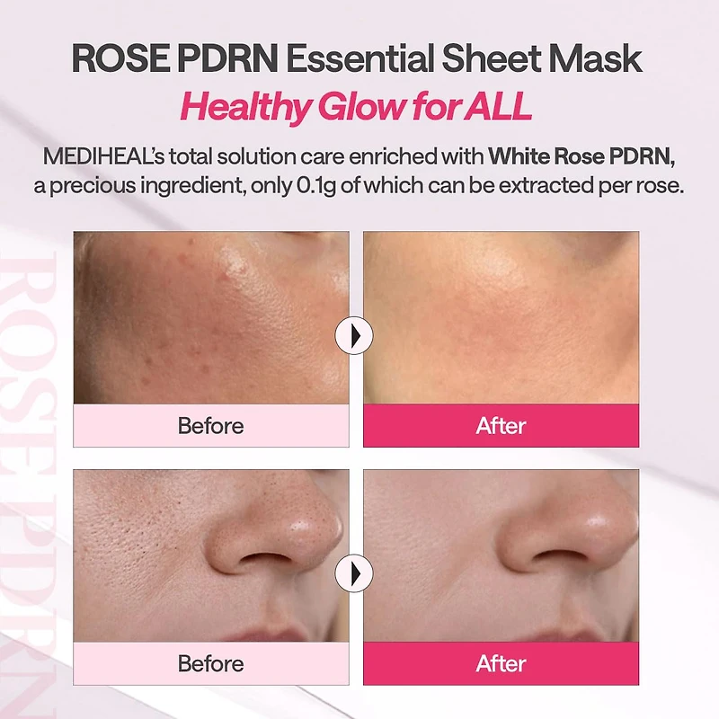 MEDIHEAL Rose PDRN Essential Mask 10pcs