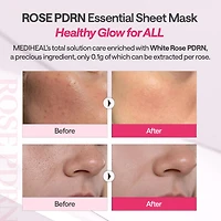 MEDIHEAL Rose PDRN Essential Mask 10pcs
