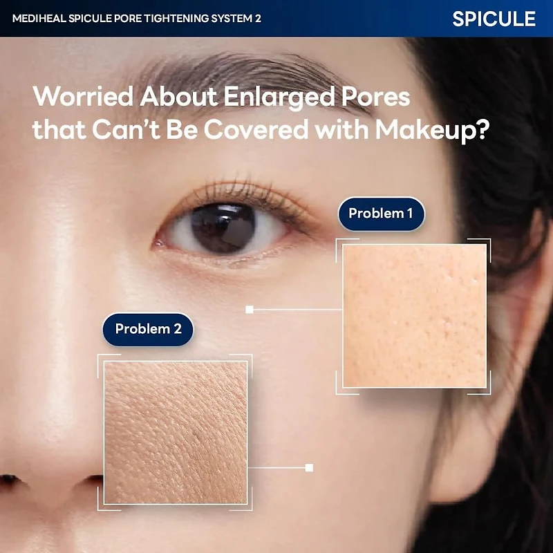 MEDIHEAL Spicule Pore Tightening System 1 Mask (4pcs)