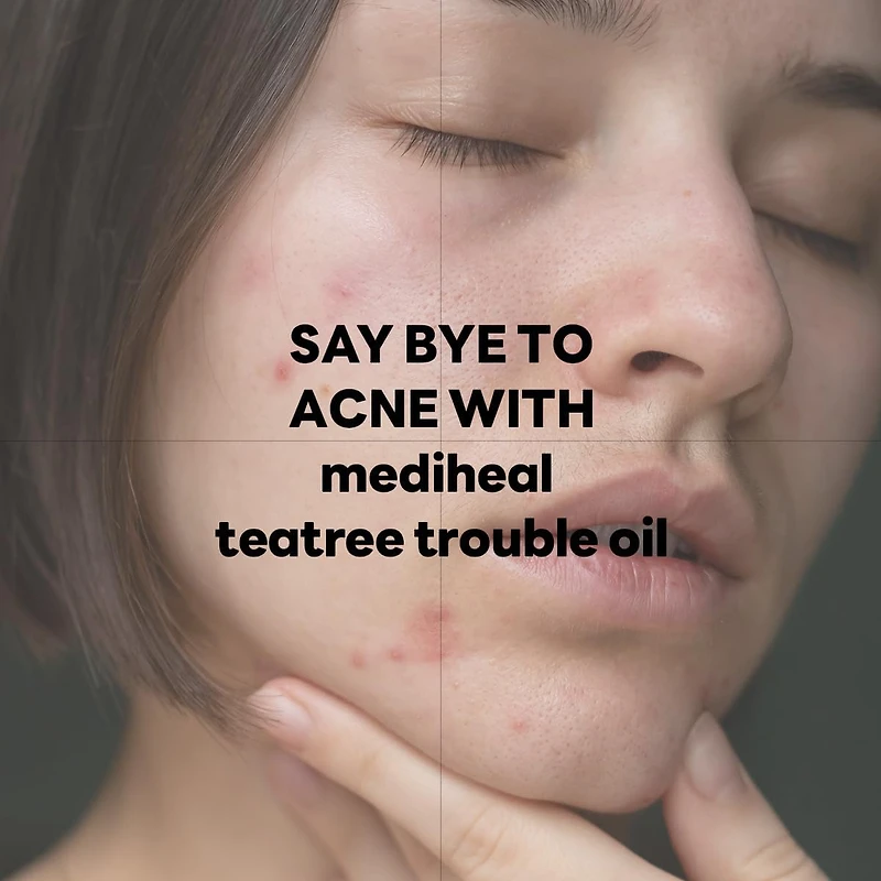 MEDIHEAL Teatree Trouble Calming Oil 10ml