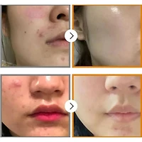 Numbuzin No.5 Goodbye Blemish Serum 50ml