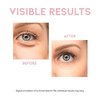 OOTD Depuff Eye Serum 30g