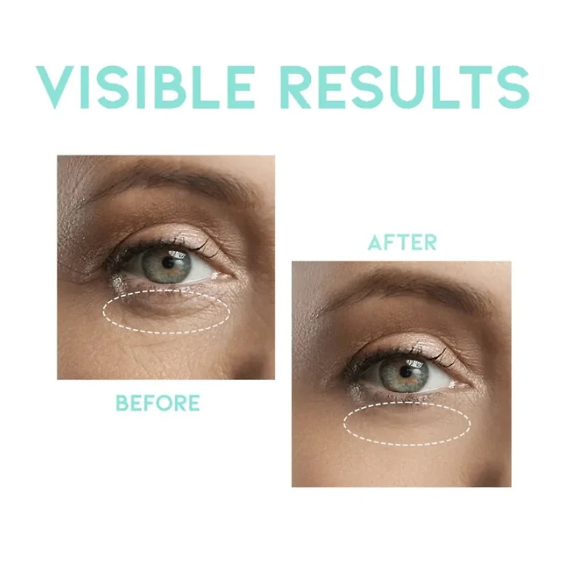 OOTD Wrinkle Lift Eye Serum 30g