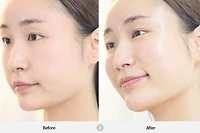 REJURAN Dual Effect Ampoule 30ml
