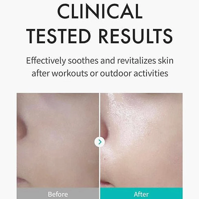 REJURAN Skin Protection Mask (5 Pieces)
