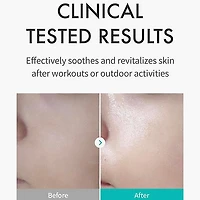 REJURAN Skin Protection Mask (5 Pieces)