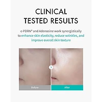 REJURAN Turnover Mask (5 Sheets)