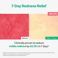 Torriden Balanceful Azelaic Acid Mask