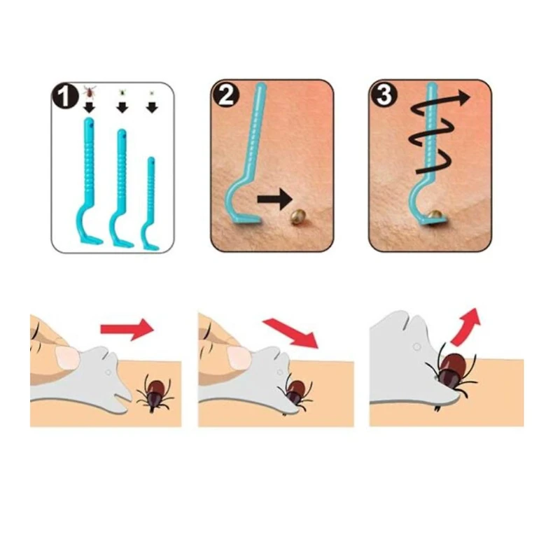 Trousse Retrait de Tiques