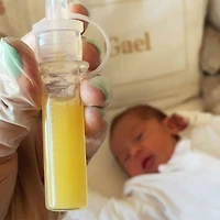 Ensemble Collecteur de Colostrum en Silicone