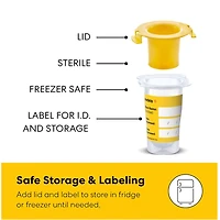Ensemble Recueil et Alimentation pour Colostrum