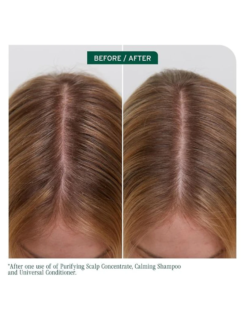 Après-shampoing universel Biolage Scalp Sync - 1L
